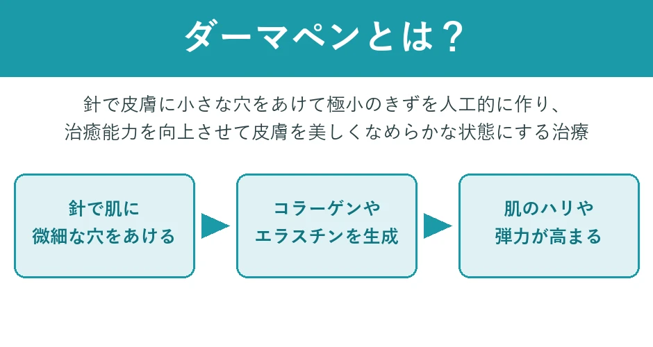 ダーマペンとは