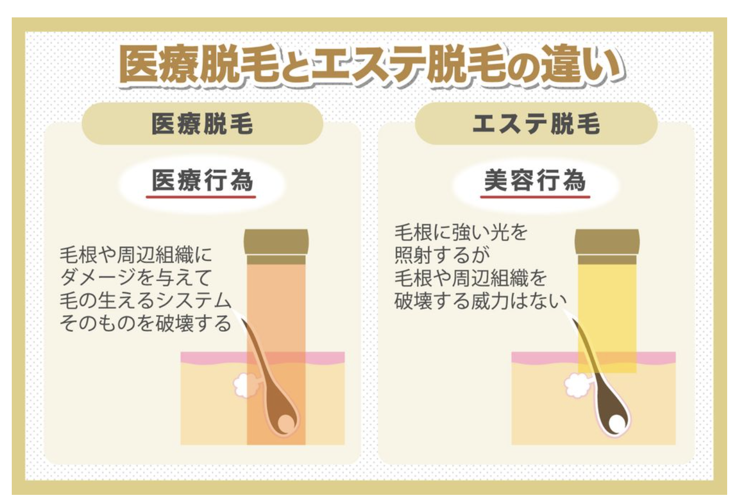 脱毛サロンと医療脱毛クリニックの違い